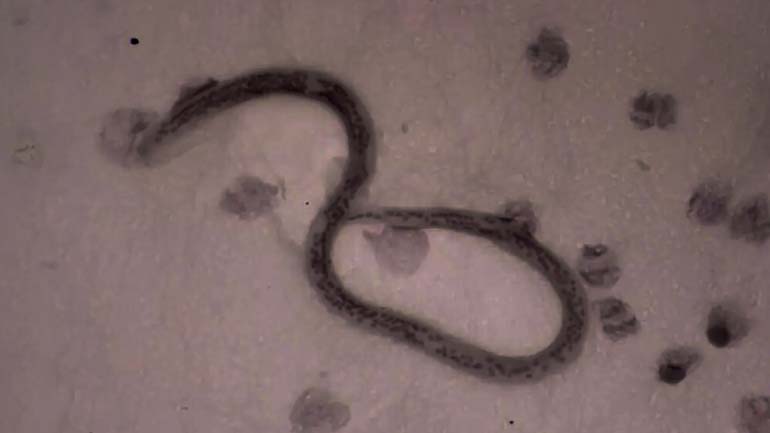 Filarial Worm